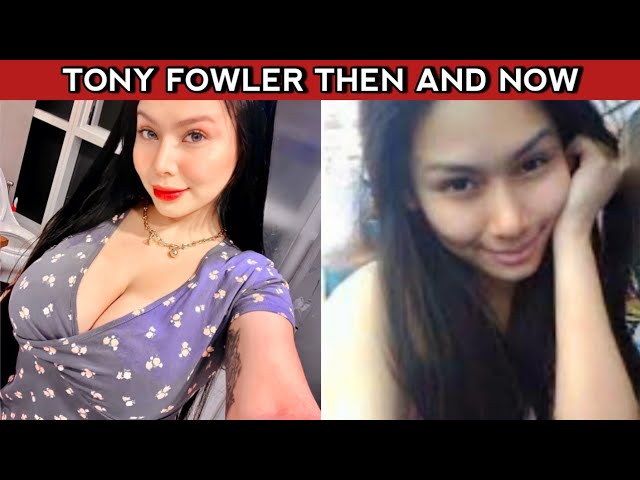 Toni Fowler Before and After